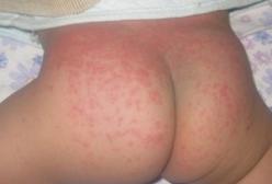 �����tƨ��