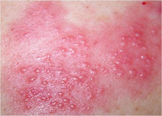 ���ӳ�ˮ���İY��^�̣�С����ˮ��ע�����