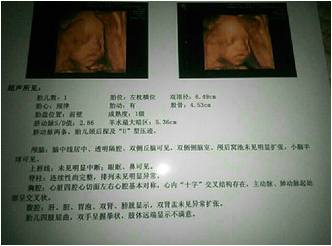 ����5����B������һ�ۿ���������Ů�᣿��ο�B����