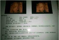 ����5����B������һ�ۿ���������Ů�᣿��ο�B����