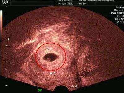 ����60�������ж�󣿑��Ѓɂ��µ�����׃��