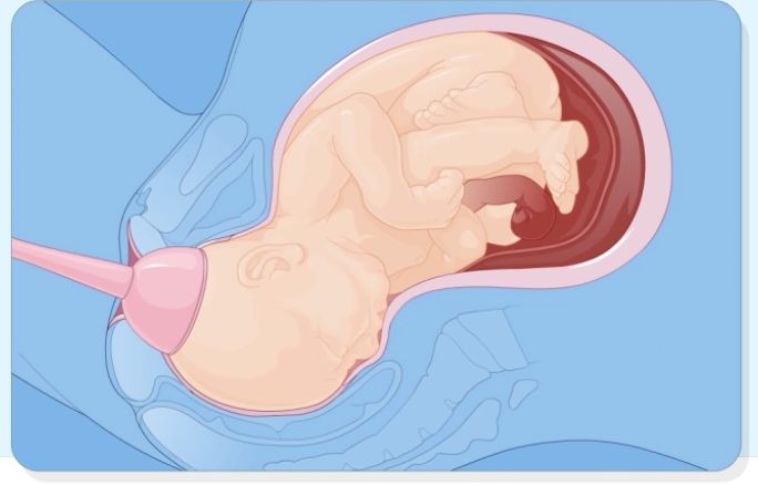 혮a���ÿ����´��߄ӣ�혮a���ж�����´�