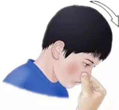 ���ӽ�������Ѫ��ʲôԭ�򣿺��ӳ�������Ѫ��ô�k