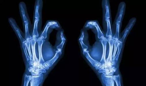 �ЋD����x�⣬������Ҫ�᣿