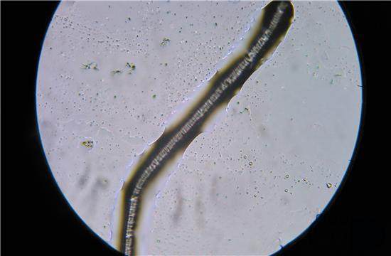 �ЋD�w���м����x��ʲô�Y��ЋD�����w���м����x��Ҫ��ʲô�z��