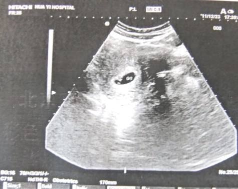 ����40��-45�����Ҷ������������