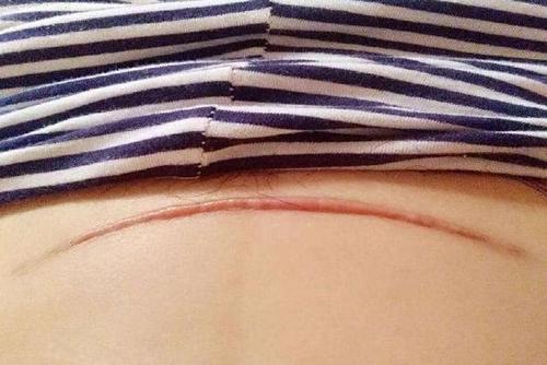 �ʌm�̺��������᣿��ε������o���ʌm�̺ۣ�