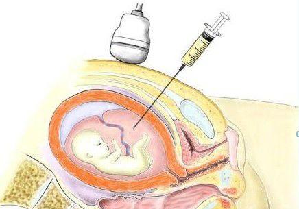 ʲô����ˮ���̙z�飿��ˮ���̙z����L�U