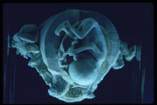 ���ӻ���̥����Ě���@�i��