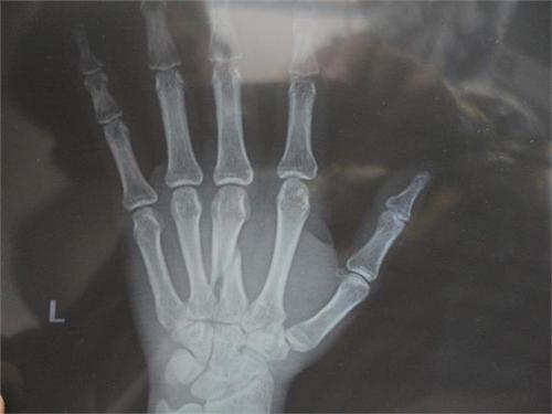 ���ӹ�����Α�(y��ng)��̎�������ӹ����o(h��)������