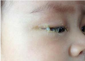 ������ʺ����ʲôԭ���������������ʺ�����r